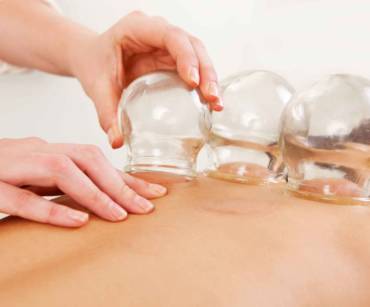 CUPPING THERAPY